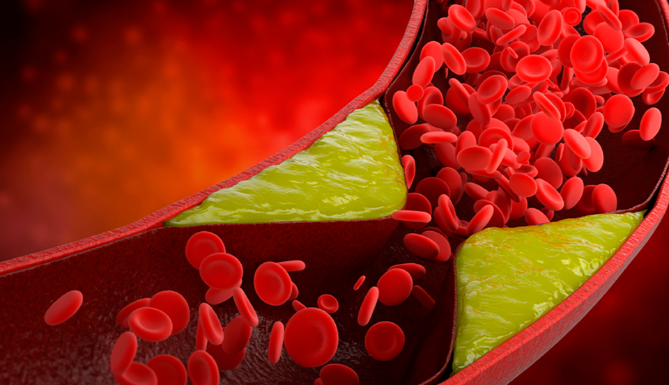 Novidades em Diagnóstico na medicina laboratorial