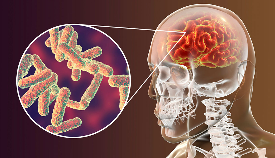 Meningites Bacterianas