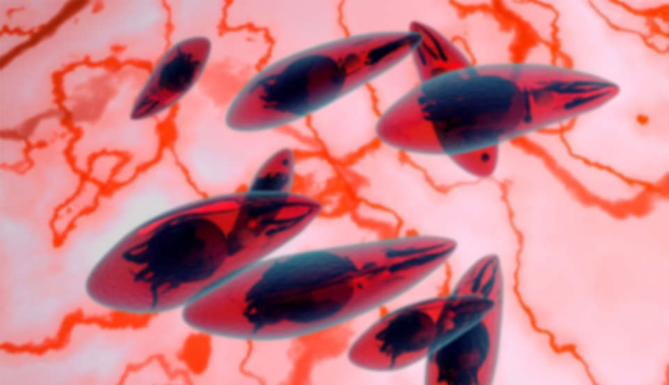 Toxoplasmose - Teste de Avidez